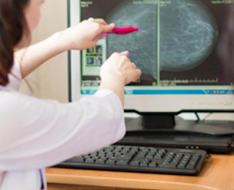 Glandular tissue associated with future breast cancer risk in women with dense breasts